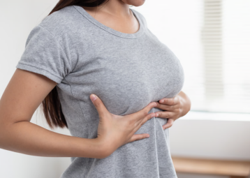 Sagging Breasts After Pregnancy , treatment in Surat by Dr. Ashutosh Shah