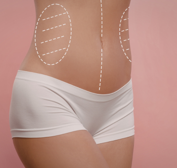 Body Contouring & Feminization in Surat by Dr. Ashutosh Shah