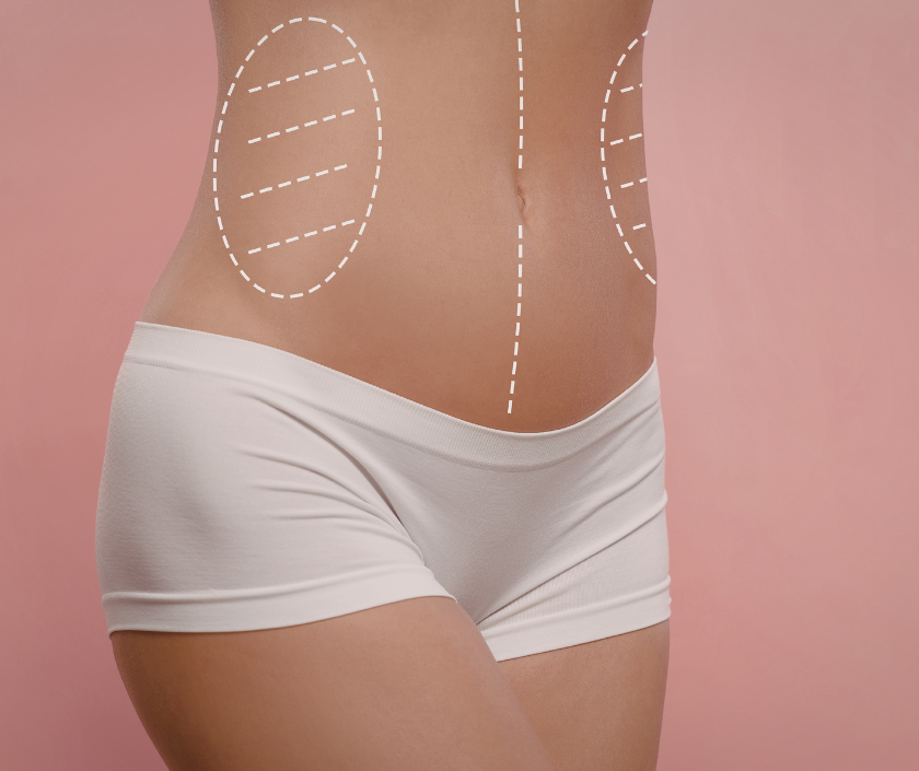 Feminization Liposculpture in India by Dr. Ashutosh Shah, Elegance Clinic