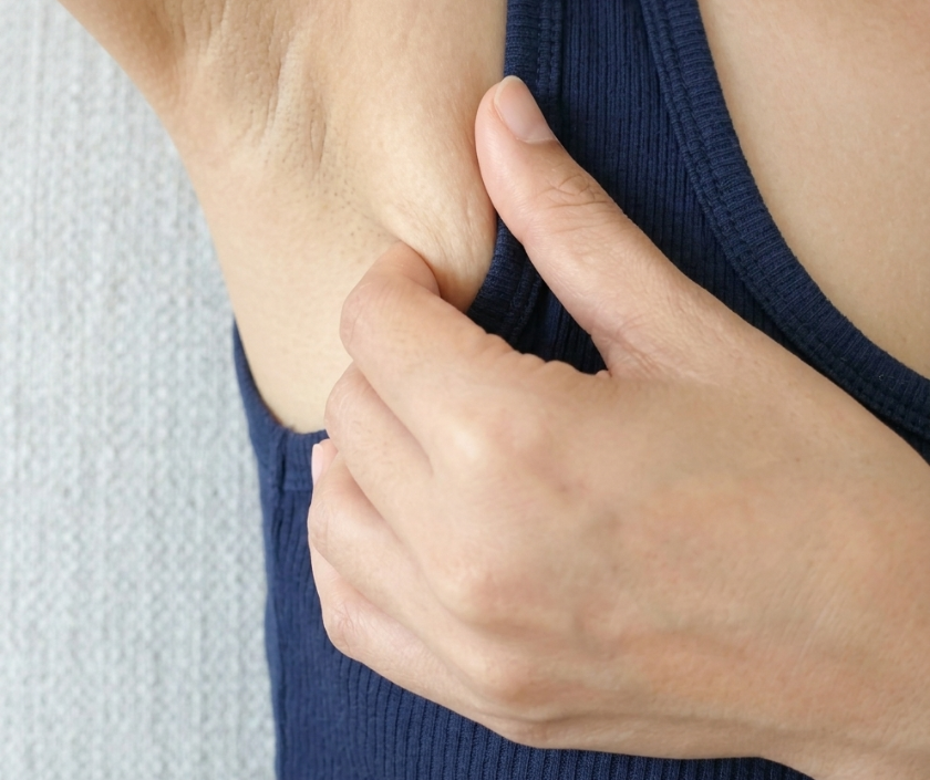 Accessory Breast Removal in India by Dr. Ashutosh Shah, Elegance Clinic