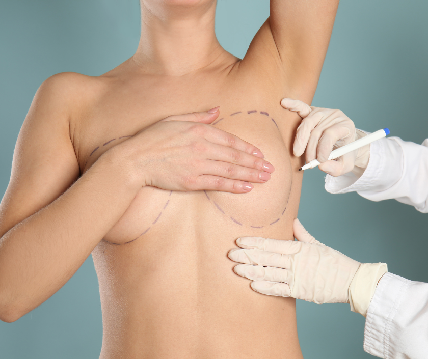 Breast Liposuction in India by Dr. Ashutosh Shah, Elegance Clinic