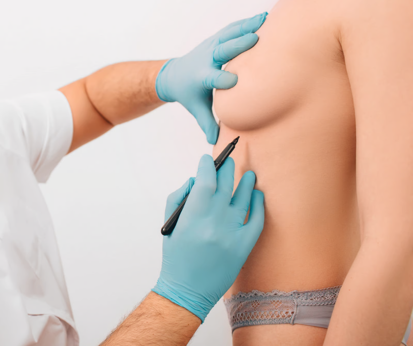 Fat Grafting Breast Augmentation, Breast Augmentation in India at Elegance Clinic, Surat