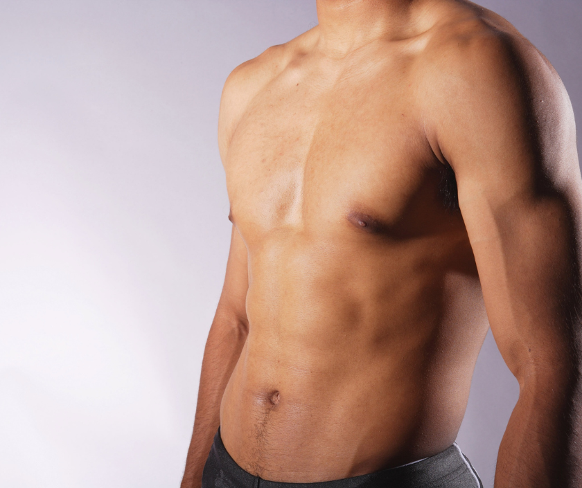 Body Contouring for the Male Chest, Pseudo Gynecomastia in India at Elegance Clinic, Surat