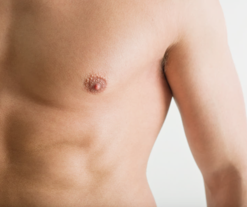 Male Chest Contouring in India by Dr. Ashutosh Shah, Elegance Clinic