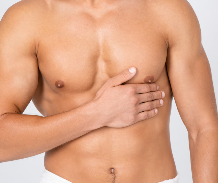 RF Chest Tightening, Pseudo Gynecomastia in India at Elegance Clinic, Surat