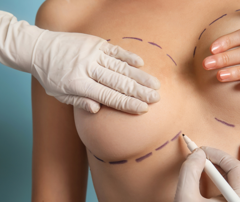 Scarless Breast Augmentation in India by Dr. Ashutosh Shah, Elegance Clinic