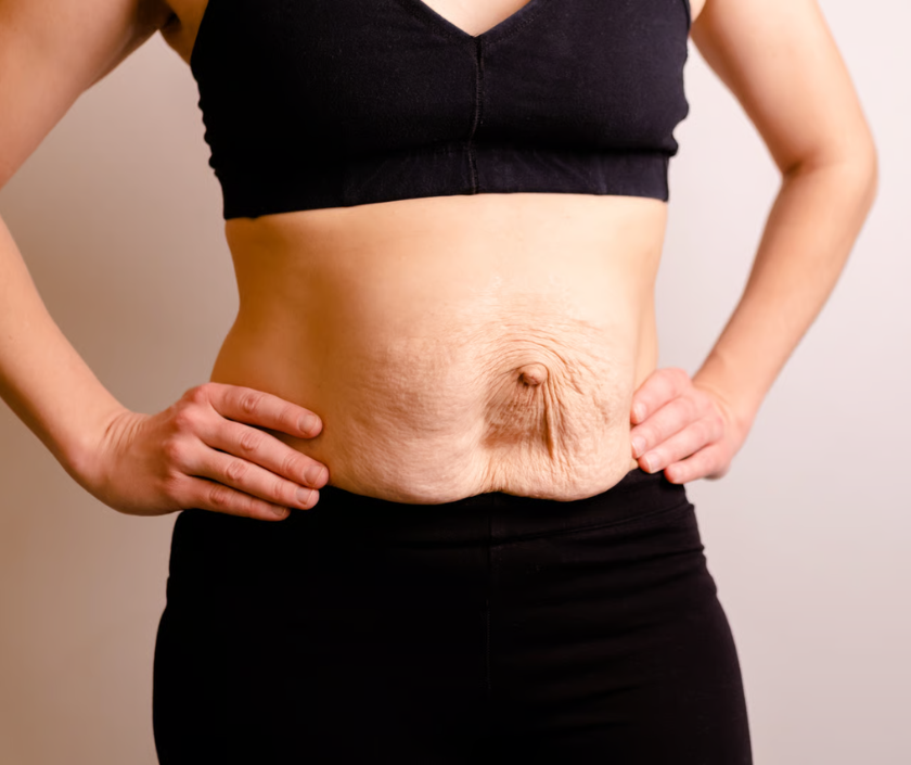 Post Childbirth Laxity Correction, Vaginoplasty in India at Elegance Clinic, Surat