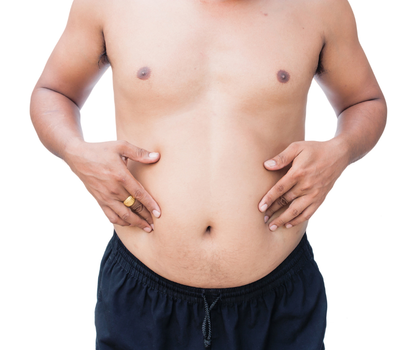 Double Incision Technique, FTM Top Surgery in India at Elegance Clinic, Surat