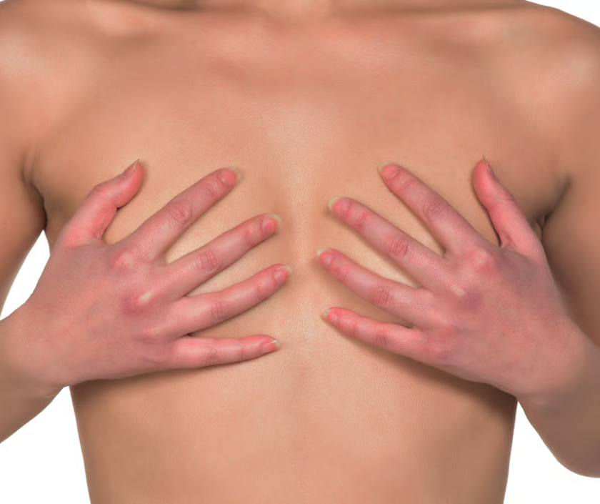 Revision Top Surgery and Scar Revision, FTM Top Surgery in India at Elegance Clinic, Surat