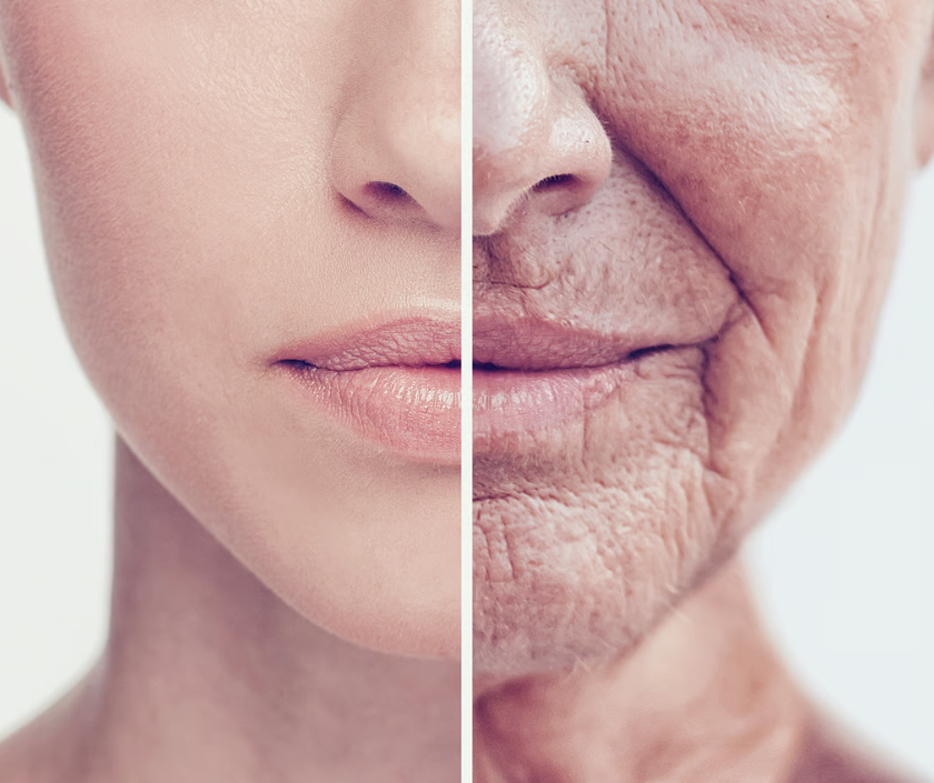 Laser Skin Tightening, Elegance Clinic, Surat Laser Skin Tightening, Perigenital Skin Tightening in India at Elegance Clinic, Surat