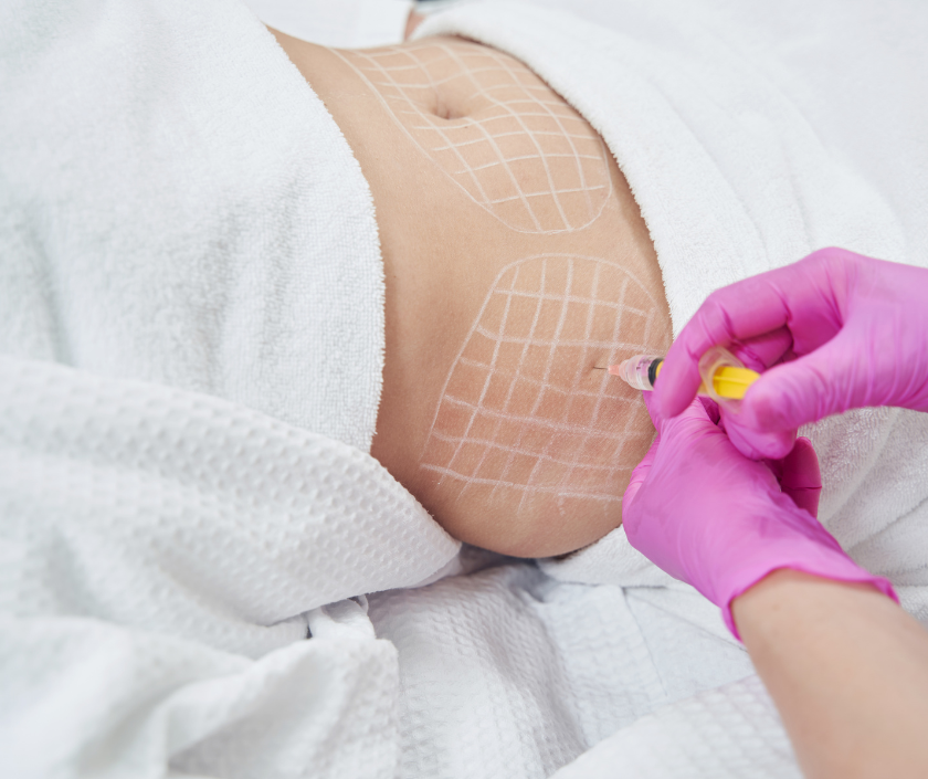 Fat Dissolving (Mons) in India by Dr. Ashutosh Shah, Elegance Clinic