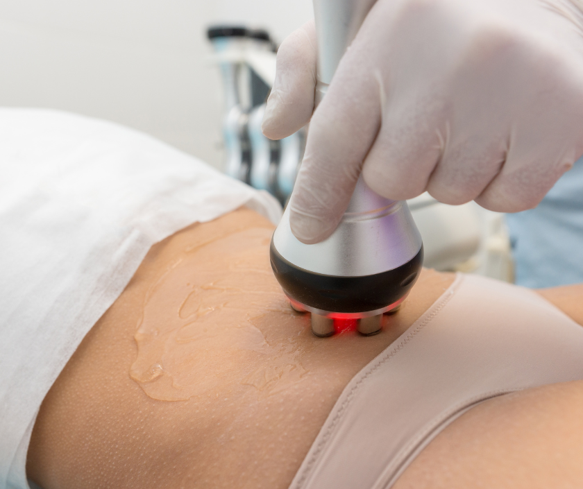RF Vaginal Tightening in India by Dr. Ashutosh Shah, Elegance Clinic