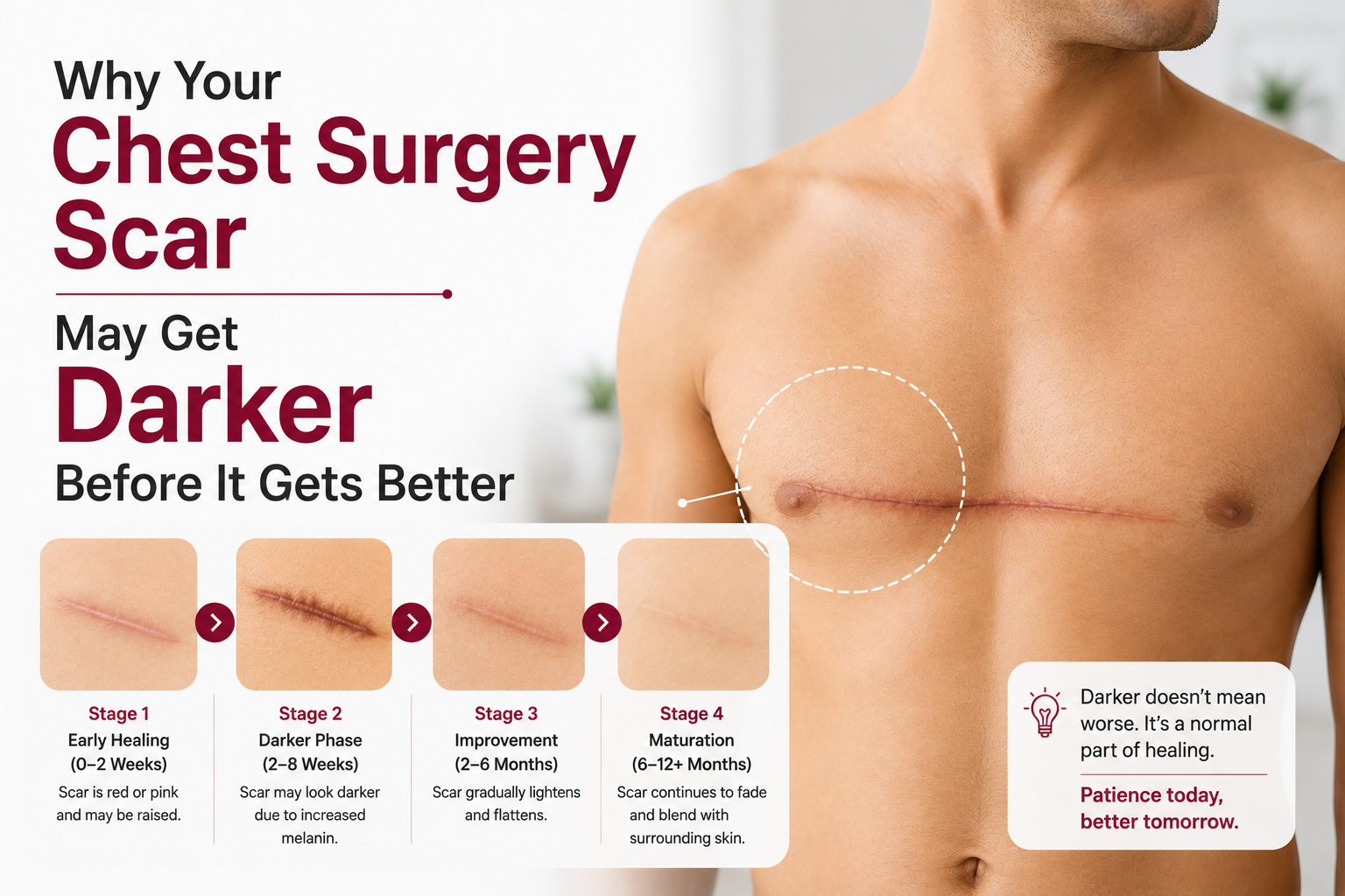 Why Your Chest Surgery Scar May Get Darker Before It Gets Better, Elegance Clinic, Surat