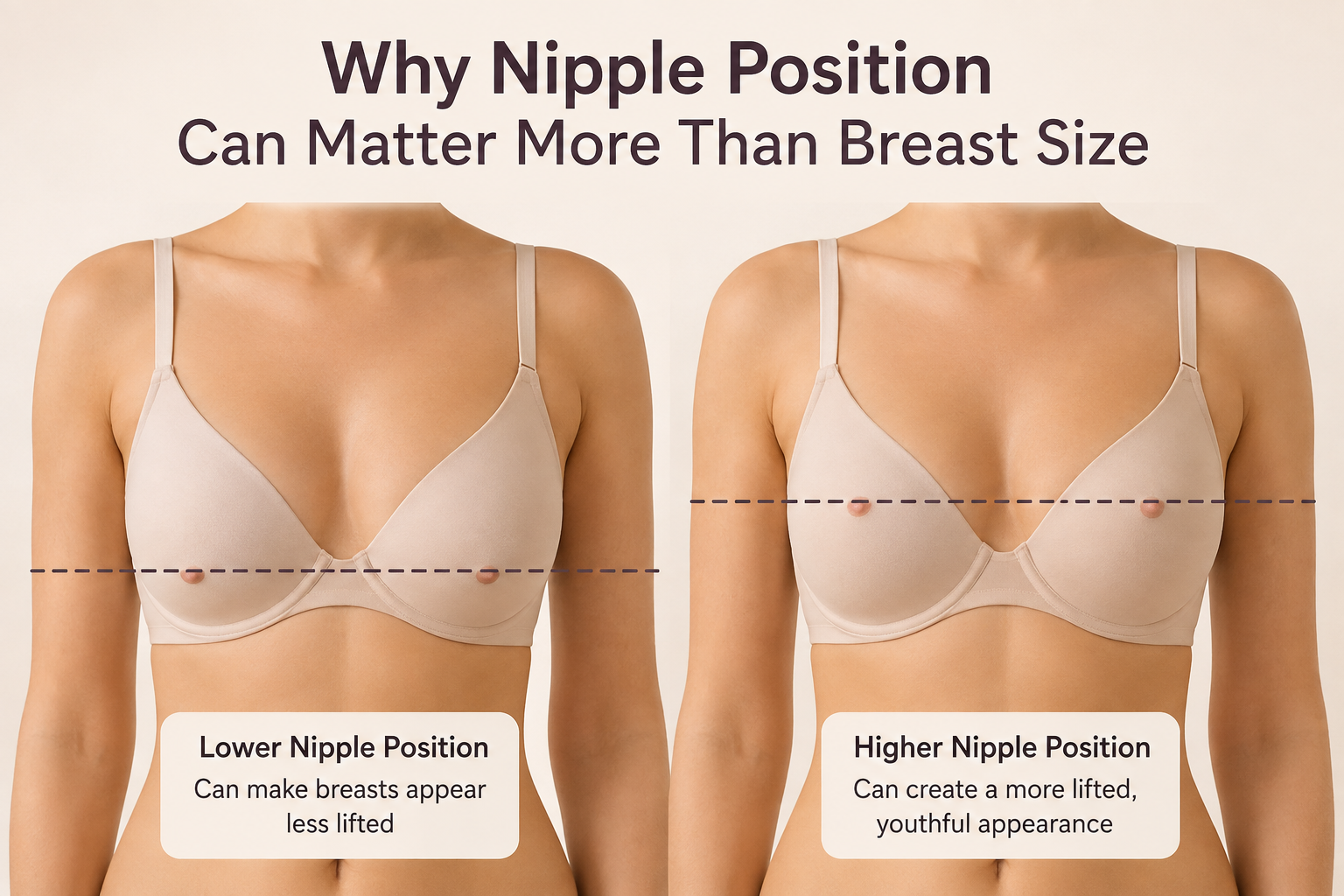 Why Nipple Position Can Matter More Than Breast Size, Elegance Clinic, Surat